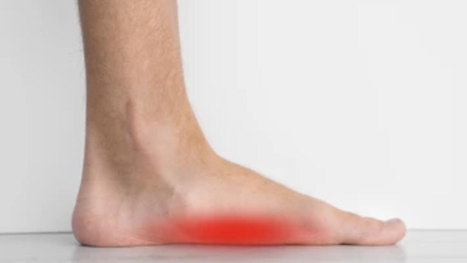 Flat Feet & Arch Problems