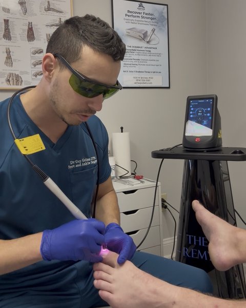 Vertex Elite Clear Nail Package: A 6-Session Laser Plan for Fungal Nails