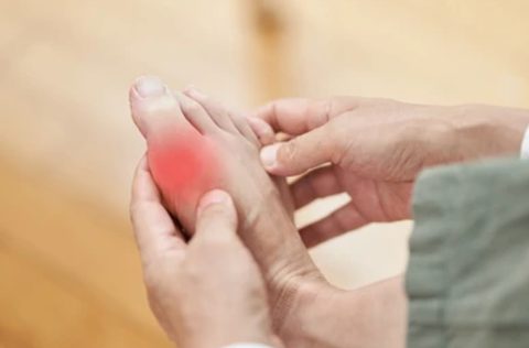Gout in the Foot: Causes, Attacks, and Modern Treatment in Columbus, Ohio